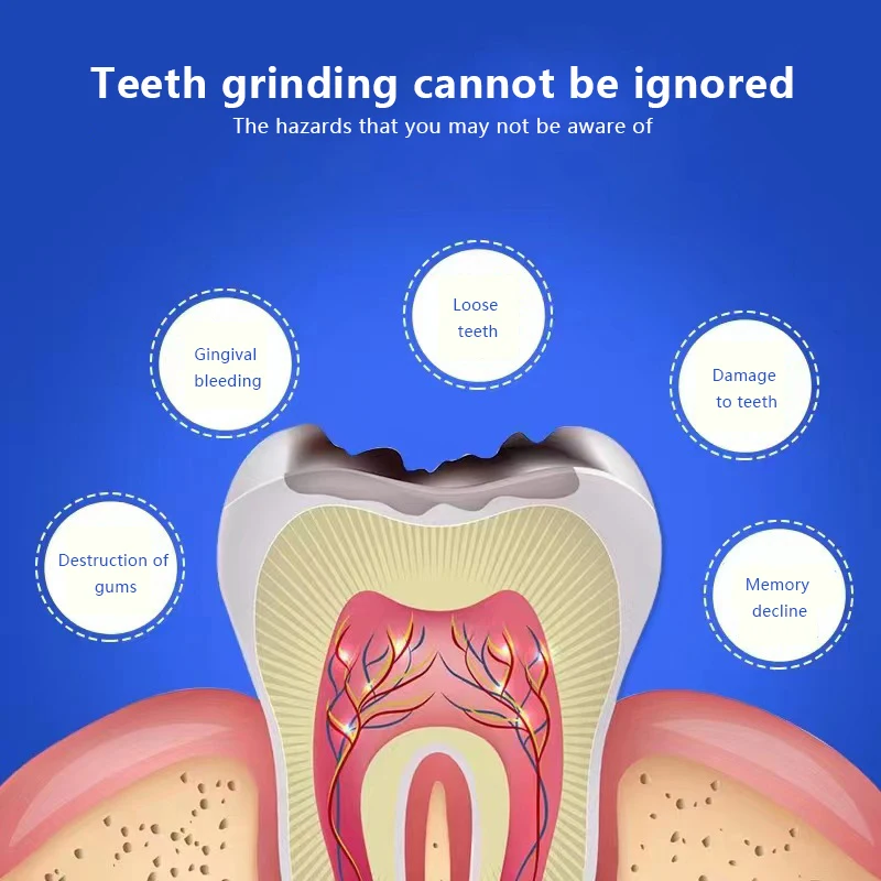 Protège-dents dentaire en silicone pour aide au sommeil, accolades anti-molaires, meulage des dents, élimination du bruxisme molaire, anti-maculage, 1 pièce