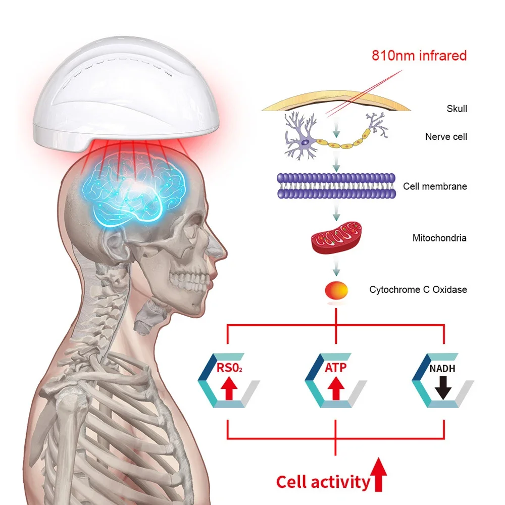 의료용 뇌 치료 LED 조명 치료 장비, 적외선 치료 헬멧, 뇌 장애용