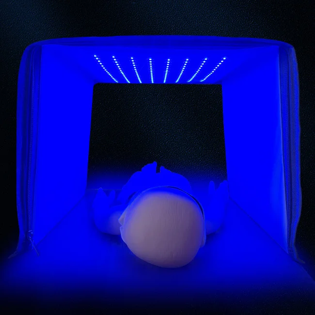 420-460 Nano Baby Care Neonatal Jaundice Phototherapy Light Emitting Diode Standing Blue Light