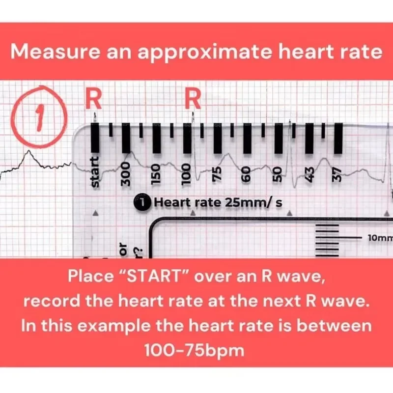 ECG 7 Step Ruler  Portable Heartbeat Ecg Observation 7-Step Scale Measurement Tool Ruler For Ecg Interpretation