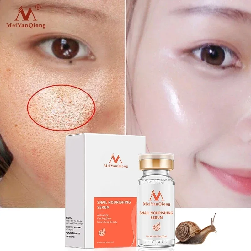 MeiYanQiong Face Serum Essence 100% Pure Plant Extract Snail Liquid Hyaluronic Acid Anti-aging Whitening Skin Anti-acne Serum