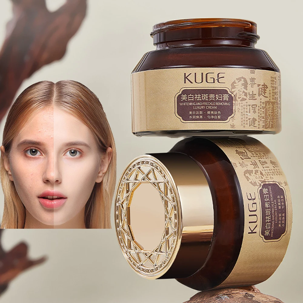 Arbutin Nicotinamide Face Cream Whitening Cream Chloasma Freckles Sunburn Dark Spots Melanin Moisturizing Skin Care Facial Cream