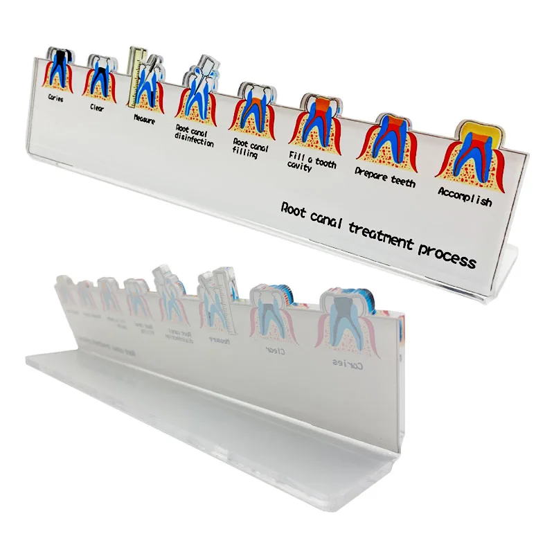 Dental Root Canal Treatment Flowchart Stand Endodontic Process Guide Dental Lab Study Teaching Demonstration Model Dentist Gift