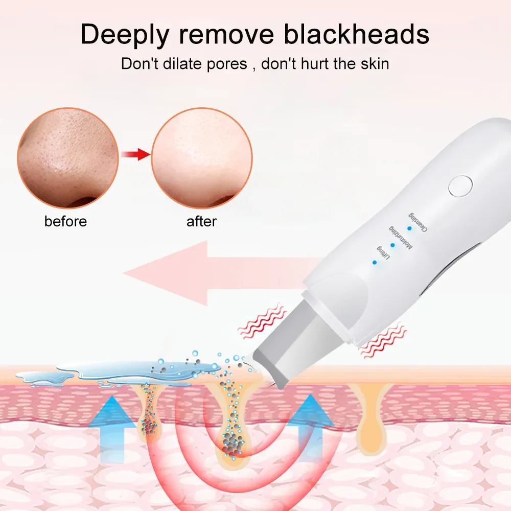 Blackhead Remover Deep Facial Cleansing Spatula Face Cleaning Lift Machine Peeling Shovel Pore Cleaner Black Dot Sebum remover