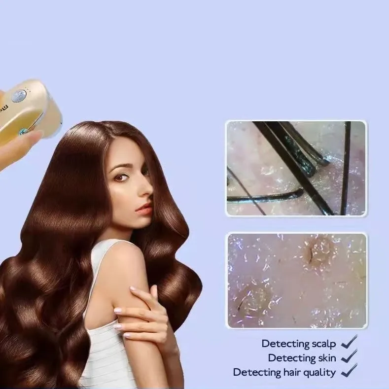 2026 Portable Digital And Hair Scalp Analyzer Diagnosis Machine