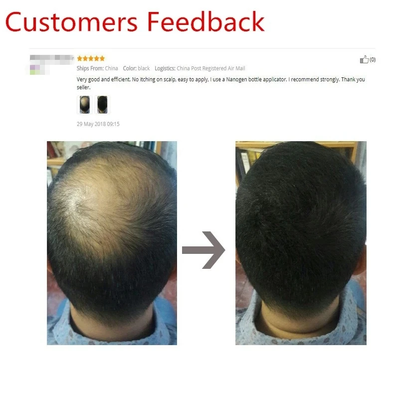 Sevich 25g Hair Building Fiber Applicator Spray Instant Salon Hair Treatment polveri di cheratina fibra per la ricrescita dei capelli 10 colori