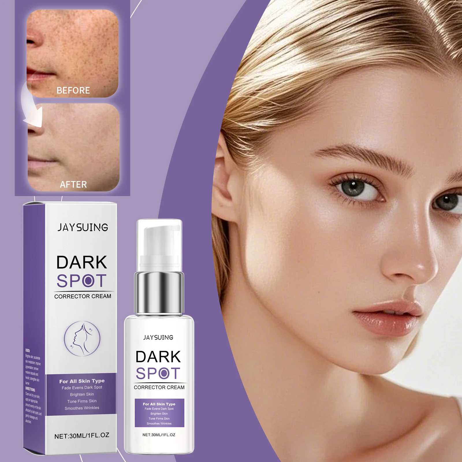 Crème correctrice de taches foncées, traitement éclaircissant clinique pour le visage, estompe l'hyperpigmentation et évacue le teint, Anti-âge