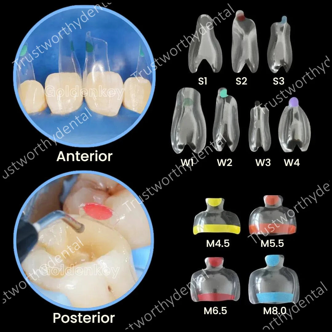10Pcs Dental Clear Matrix Fits Bioclear BT Matrice Anterior Posterior Transparent Molar Bow Class Restoration Black Triangle