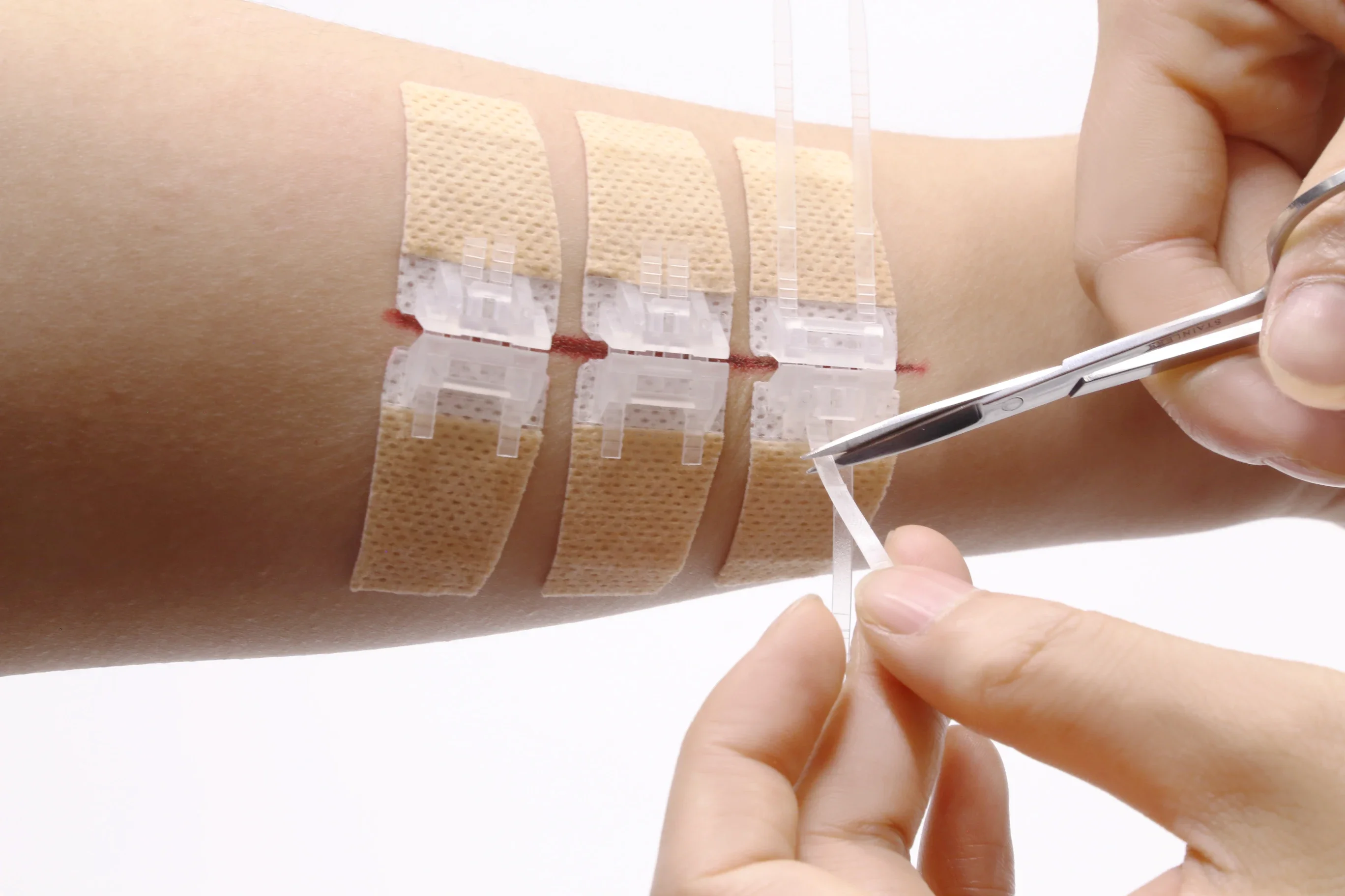 

Emergency Wound Closure Device, Zip Sutures Butterfly Kit , Zip Stitch Sutures Butterfly Band-aids