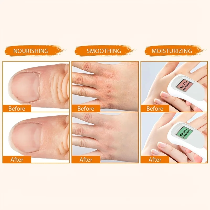 كريم اليد الشتوي 20 جرام. يترطيب عميق لليدين الجافة ويمنع جفاف وتكسير اليدين وغير دهني. #3