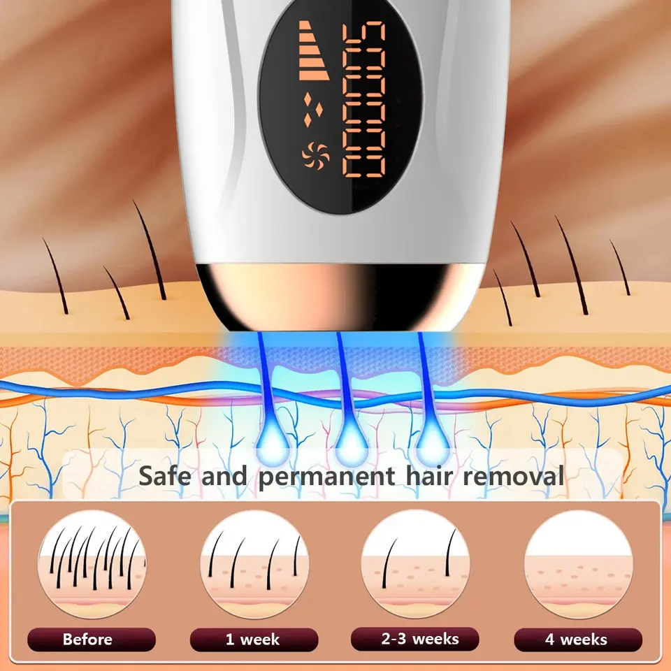 جهاز إزالة الشعر بالليزر IPL من HOMEFISH لإزالة شعر الجسم والبيكيني والوجه 990000 ومضة دائم بلا ألم - 6