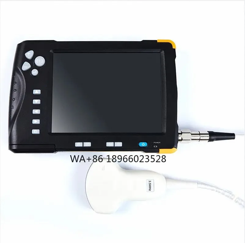 

Custom High Quality Tablet Probe Portable Wifi Wireless Ultrasound Scanner