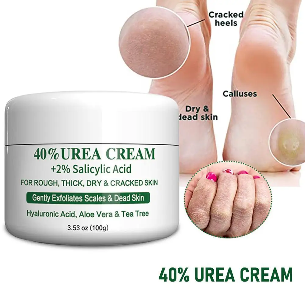 40%/42% Urea Cream Anti Cracked Exfoliating Remove Hand Skin Skin 100g Dead Care Nourishing Feet Moisturizing Repair Skin ﻿