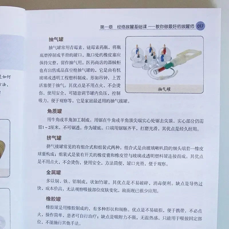 Schröpfen Gesundheit Körper Entfernung Buch Illustrierte TCM Akupunkturpunkt Null-basierte Schröpfen Einführung Schröpfen Technik Tutorial