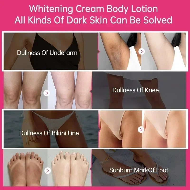 Crema blanqueadora corporal para axilas, piernas, rodilla, codo, axila, mejora opaca, elimina manchas oscuras, ilumina la piel