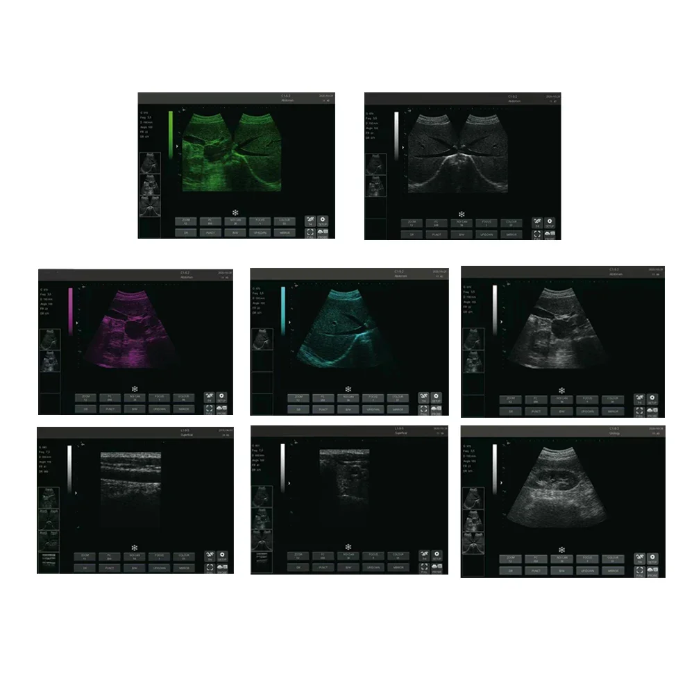 Profesjonalne medyczne instrumenty ultradźwiękowe cena skanera usg metodą dopplera przenośny kolor maszyna ultradźwiękowa wózka 4D