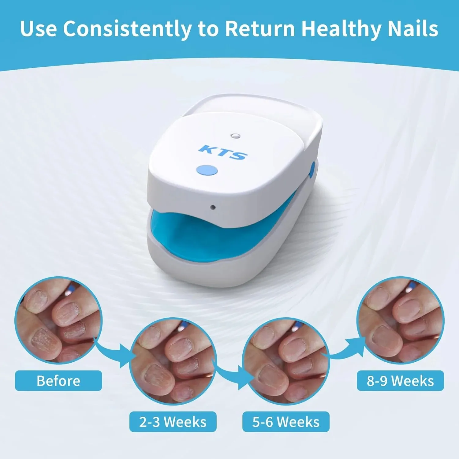 Laser Fungal Nail Treatment Device for Toenail 470nm+910nm Repair Fast Nail Fungus Onychomycosis Fungus Cleaning Laser Device