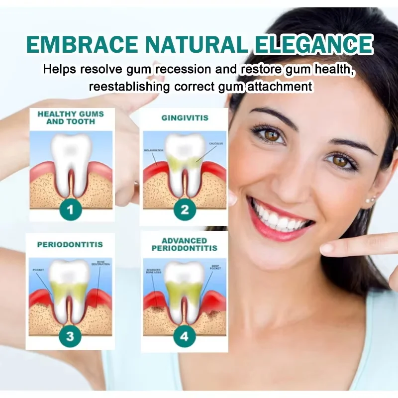 Damaged Gum Repair Care Gel Relieve Sore Gums Allergy Deep Cleaning Teeth Stains Tartar Serum Dental Caries Toothpaste