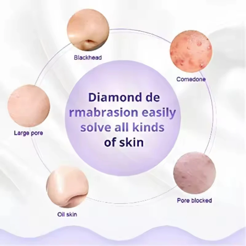Dispositivos dermoabrasão diamante acessório 9 dicas 3 varinhas para peeling da pele facial removedor cravo cuidados com o rosto beleza