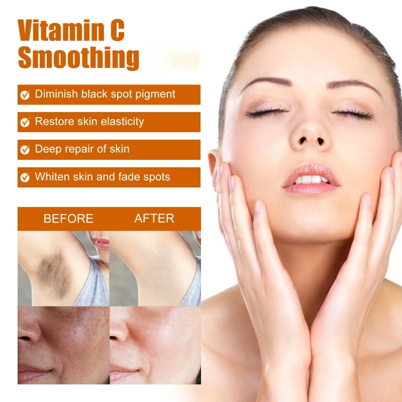 Vitamin C Whitening Soap Deep Cleansing Remove Dark Spot Improve Pigmentation Gentle Nourishing Bleaching Brightening Skin 100g