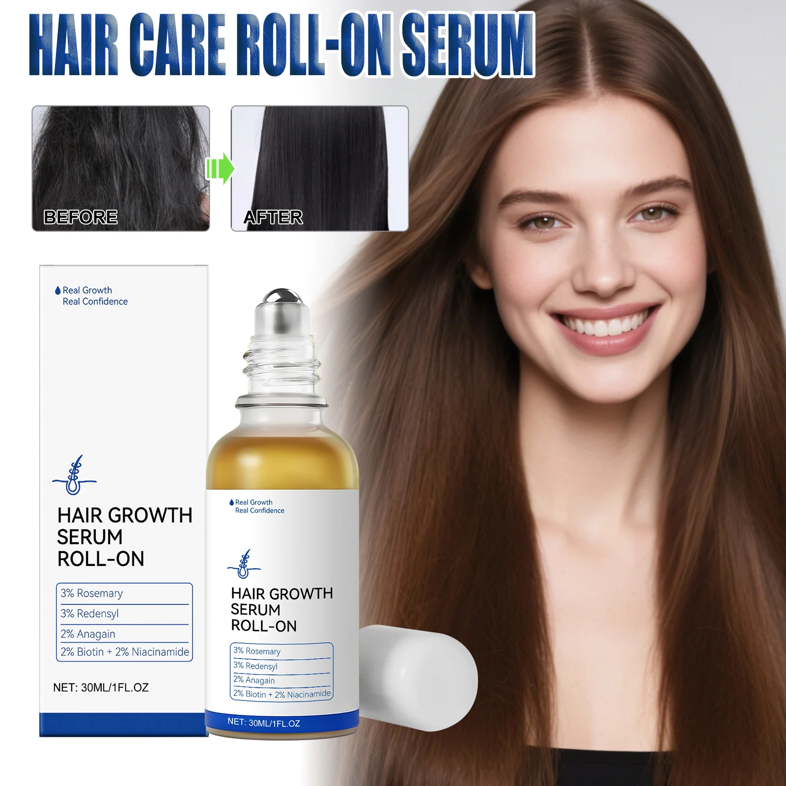 

Роликовая сыворотка для ухода за кожей головы, глицерин, масло розмарина для укрепления волос, питает волосы, фолликулы, уменьшает ломтик для мягких волос