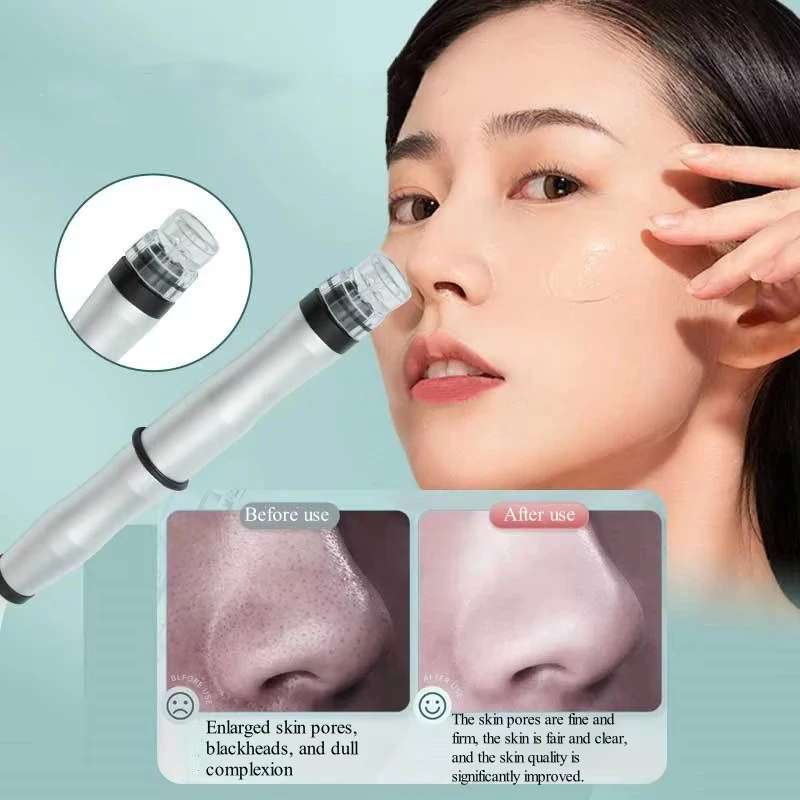 أحدث مزيل الرؤوس السوداء فراغ منظف مسام الوجه أداة شفط الطاقة الكهربائية آلة معالجة الوجه لصالون المنزل #4