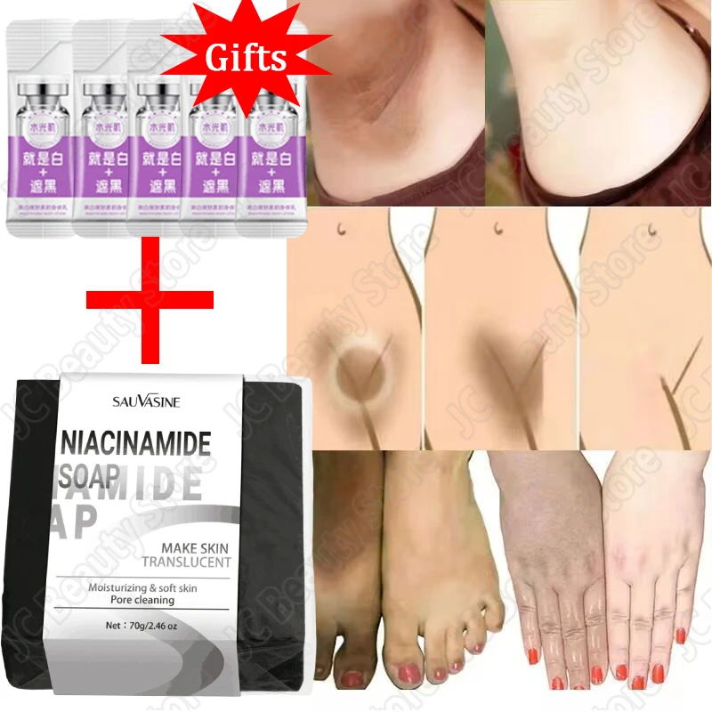 Body Whitening Cream Fast Bleach Private Parts Lighten Underarm Knees Melanin Brighten Soap Intimate Areas Remove Dark Spot Care