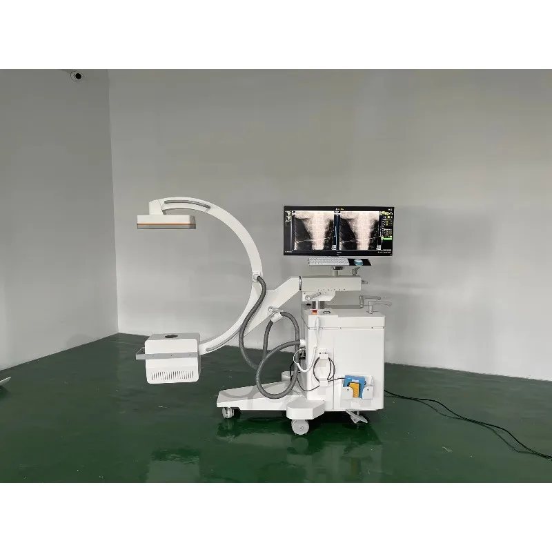 Hospital medical high frequency mobile c-arm system operating table surgical x-ray c-arm system