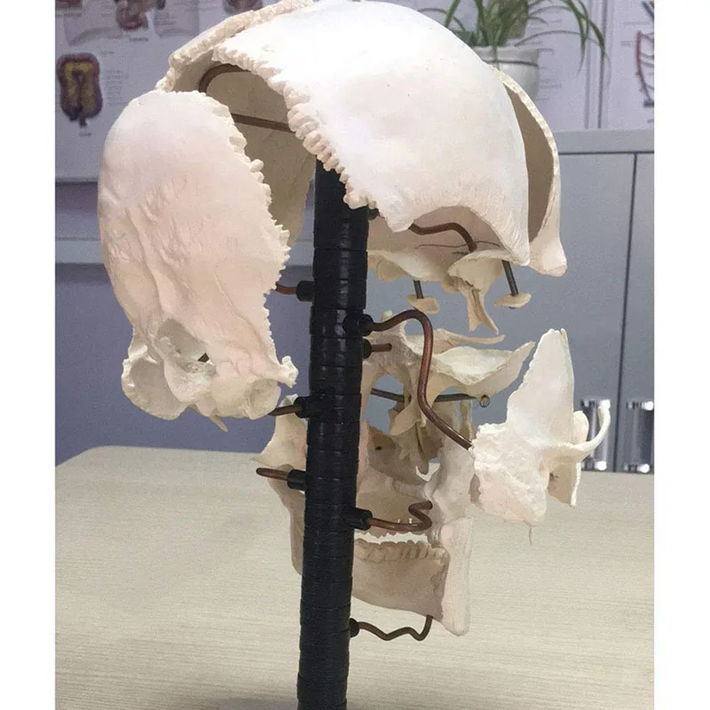 Human skull parts (16 pieces) Human skull model Human skull model Skull separation anatomical medical bone model