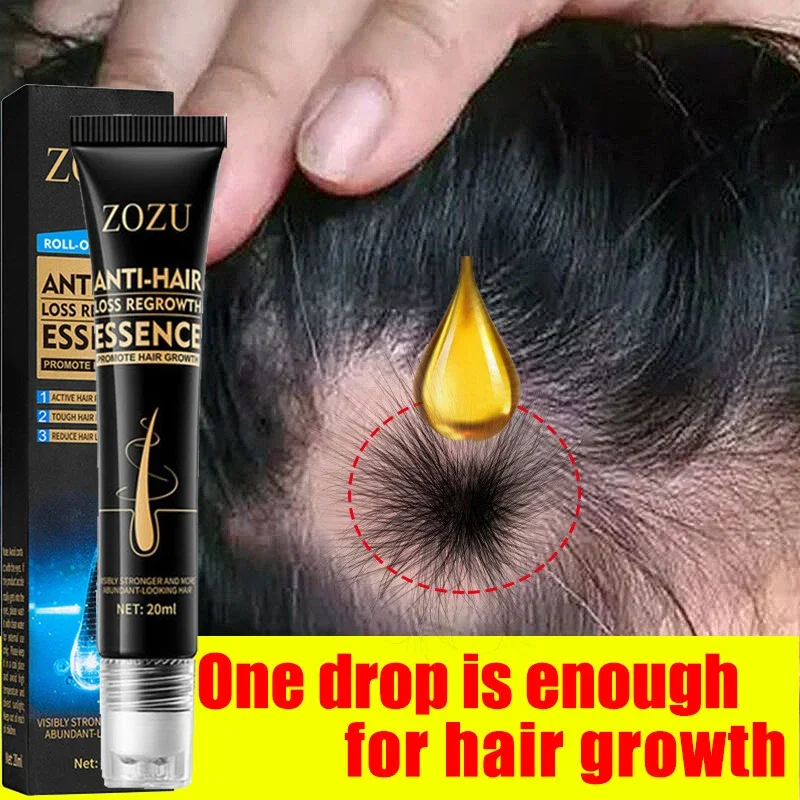 

Fast Hair Growth Effective Anti Serum Baldness Repair Hereditary Postpartum Seborrheic Hair Loss Beauty Products Fast Shipping