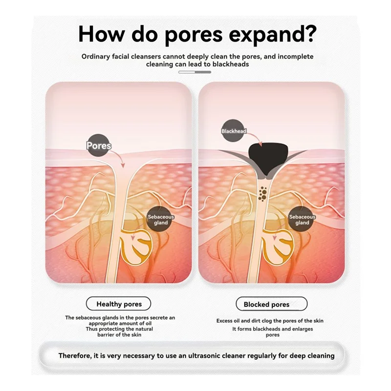 A39M Beauty Device, Deep Cleansing Facial Face Scrubber Skin Spatula Blackhead Remover Tools