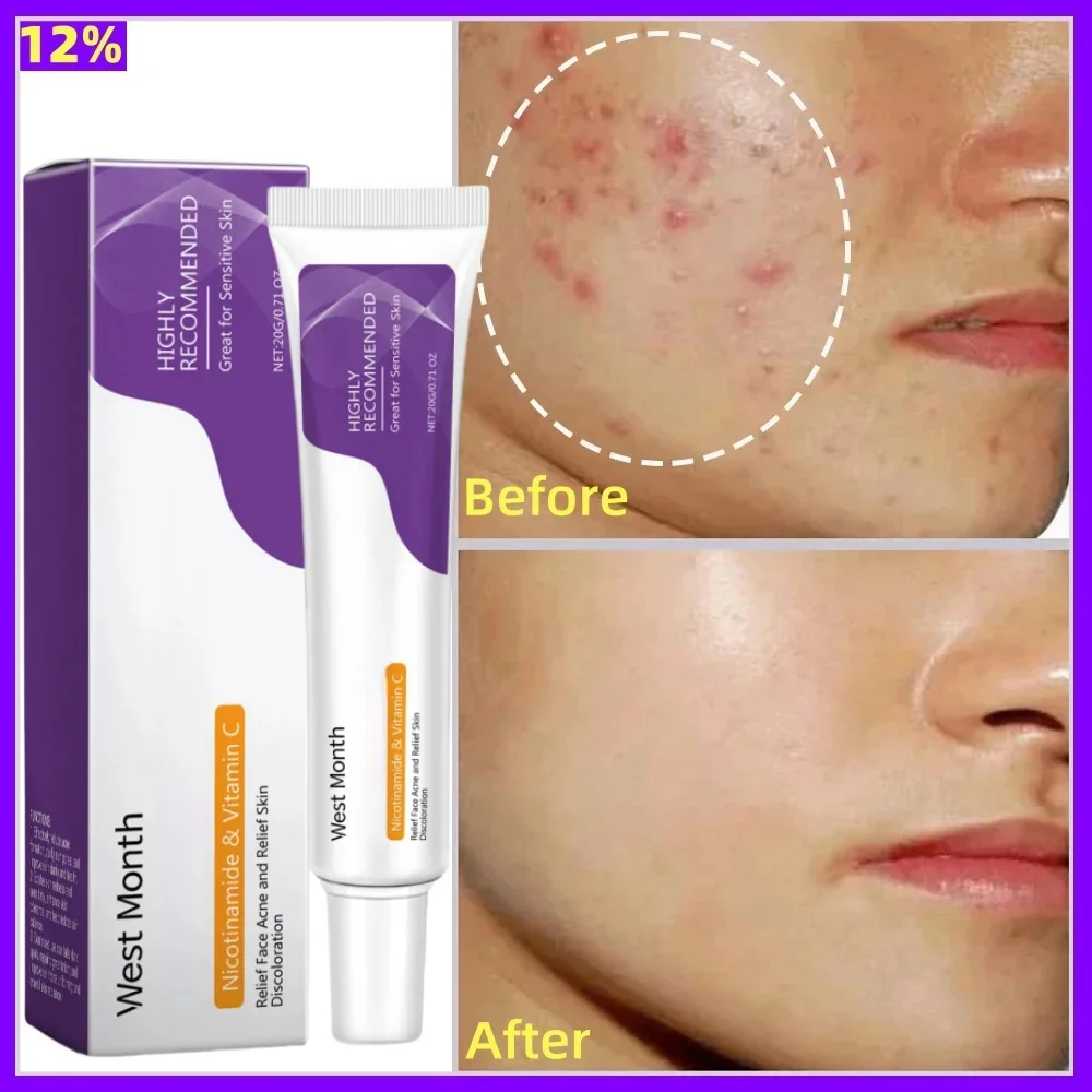 

Salicylic Acid Pore Shrink Cream Quick Remove Blackehead Acne Tighten Face Smooth Skin Elimination Pores Korean Care Product