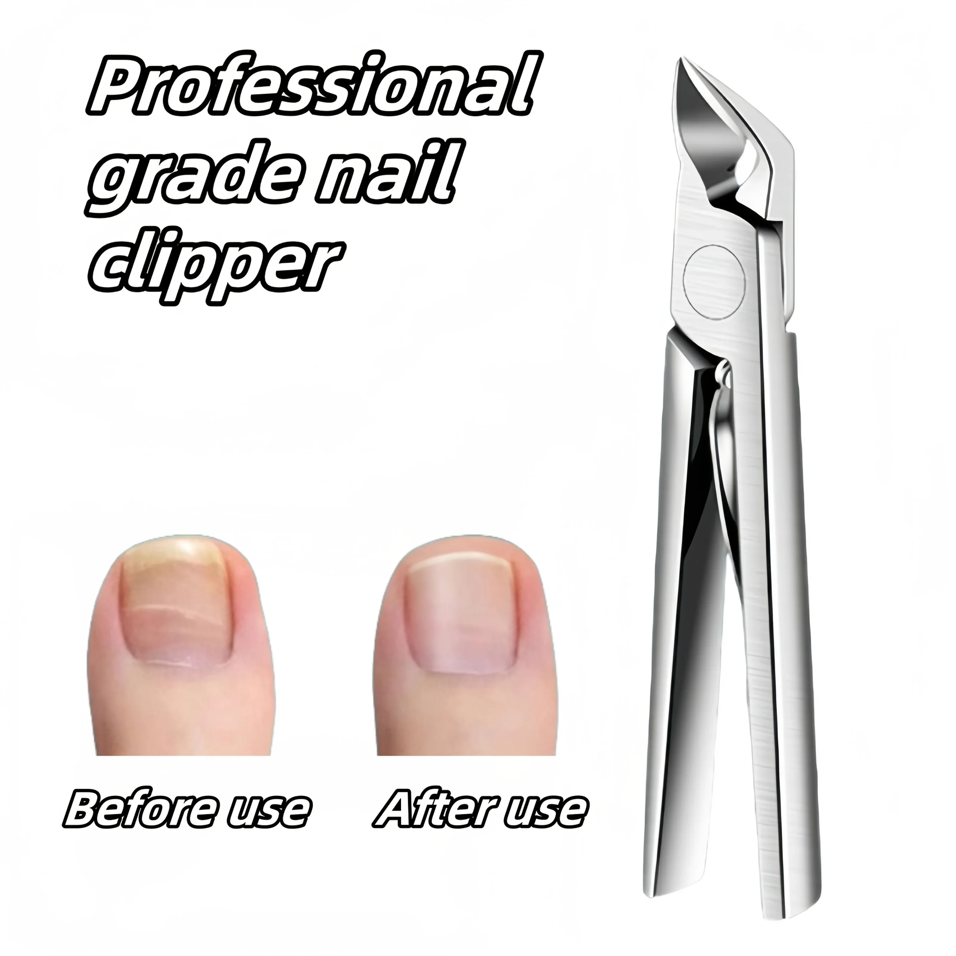 Stainless Steel Ingrown Toenail Clipper with Dead Beige Tweezers Extended Tip Design, Suitable for Thick/Soft Nails