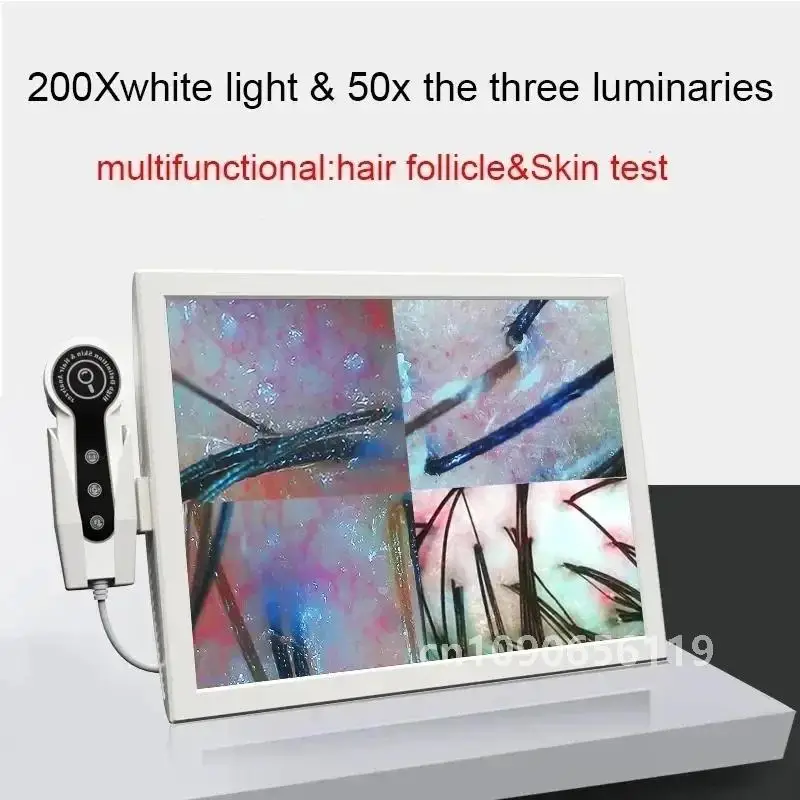 15 Inch Screen Ultra Hair Skin Analyze HD Intelligent Beauty Salon Home 50/200 Times Lens HD Scalp Hair Detector Skin Analysis