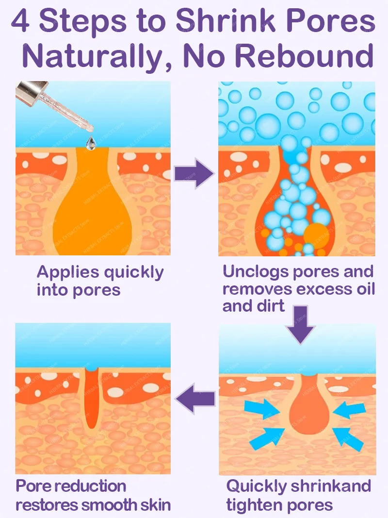 Sérum minimiseur de pores pour le visage, resserre les pores, resserre la contraction