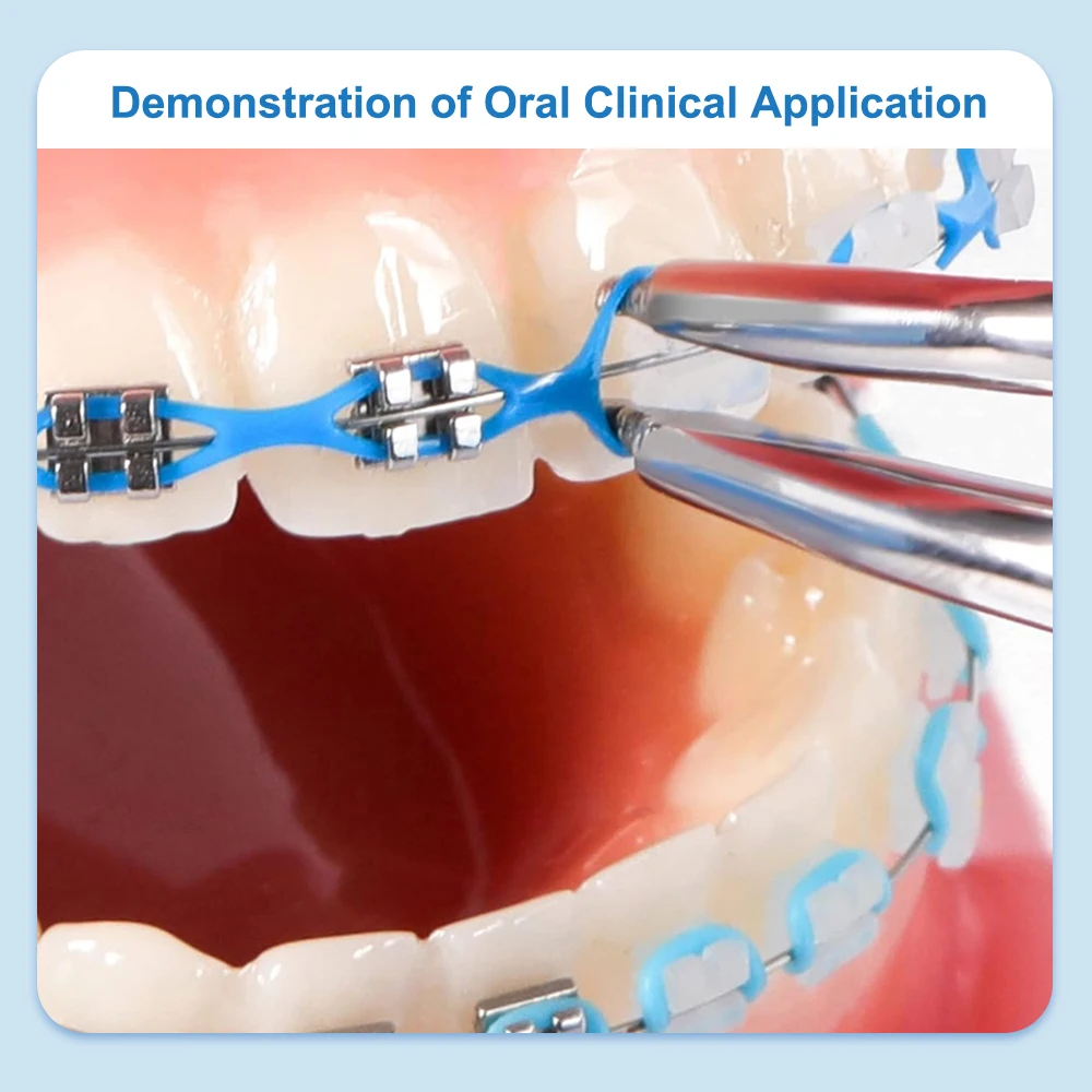 Рисунок 6 - Ортодонтическая цветная эластичная