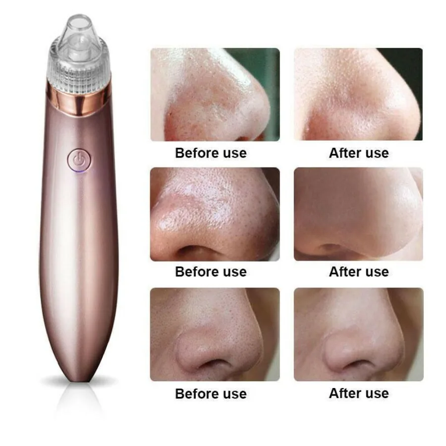 

Electric Black Vacuum Pore Cleaner Acne Pimple Remover Strong Suction Tool Electric Black Remover Pore Vacuum Suction Diamond D