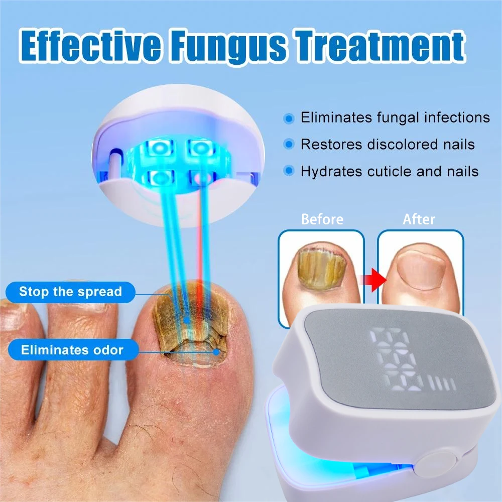 LCD Display Fungal Nail Laser Device Repair Toenail Nails Fungus Onychomycosis Nails Fingernail Effectively Removes Nail Fungus