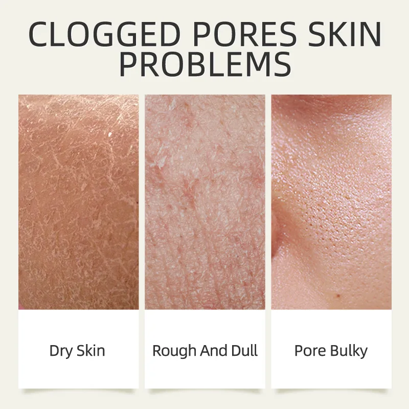 قناع LAIKOU Longjing Matcha منعش للترطيب والترطيب