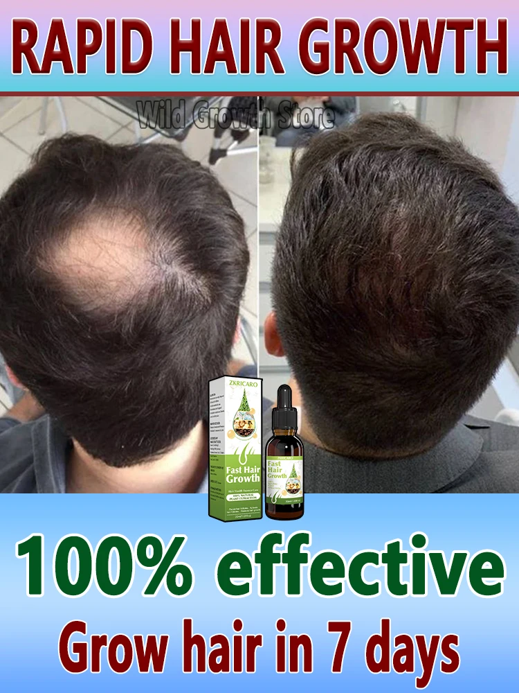 Hot selling hair growth products, fast, help, hair, grow. Fix hair loss, fix baldness.