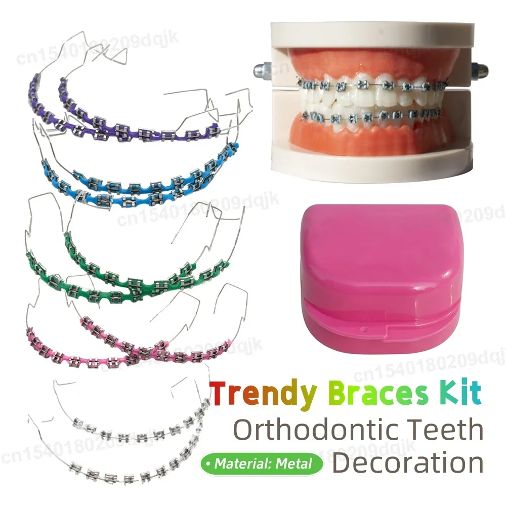 1 زوج الأقواس الموضة مع صندوق الملونة الأسنان الديكور مع الأسلاك المعدنية كتيفة معدنية العلاقات الأوعية الدموية تقويم الأسنان #1