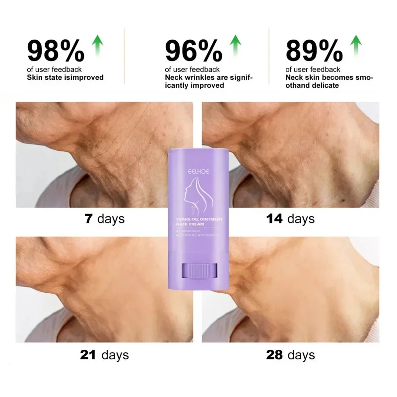 Nek Anti-Rimpel Crème Stick Anti-Aging Lifting Verstevigende Fijne Lijntjes Hydraterende Helderende Schoonheid Huidverzorging Korea Cosmetica