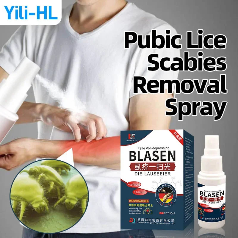 

Pubic Lice Scabies Treatment Spray Head Lice Eggs Remover Antibacterial Anti-Itching Mites Removal Medicine German Secret Recipe