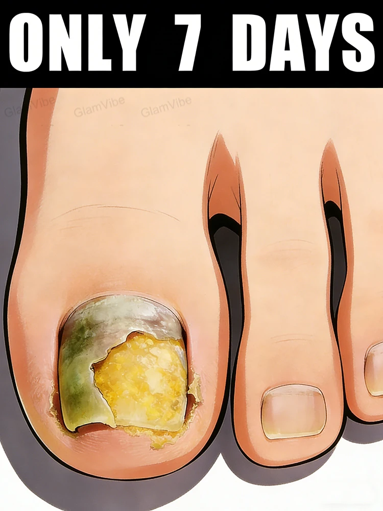 

No More Yellow Dull Nails, Restore Transparent Shine