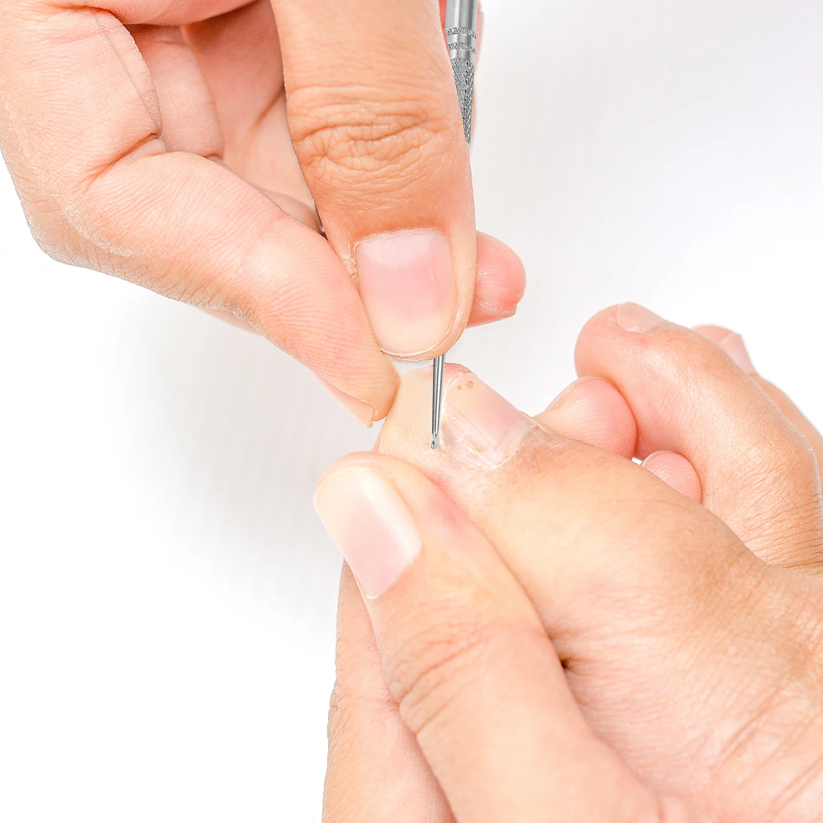 

1Set Toenail Orthopaedic Stickers Ingrown Nail Correction Strips Toenail Repair Tools Foot Nail Healing Patches