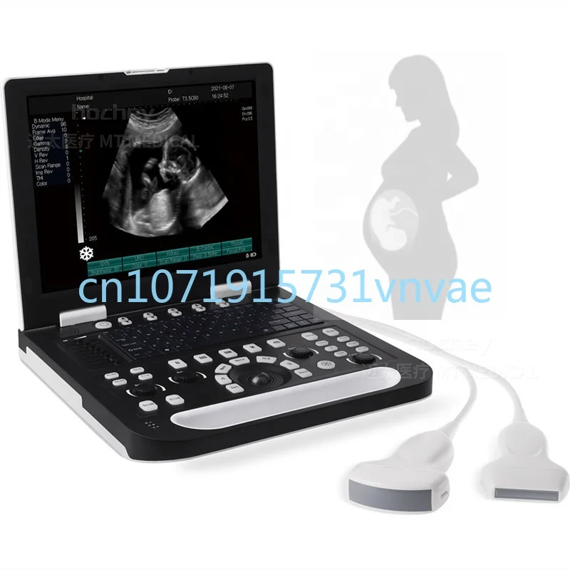 MT Medical Equipment Portable 15 Inches LCD Display Full Digital Laptop Vet Ultrasound Animal Scanner Machine