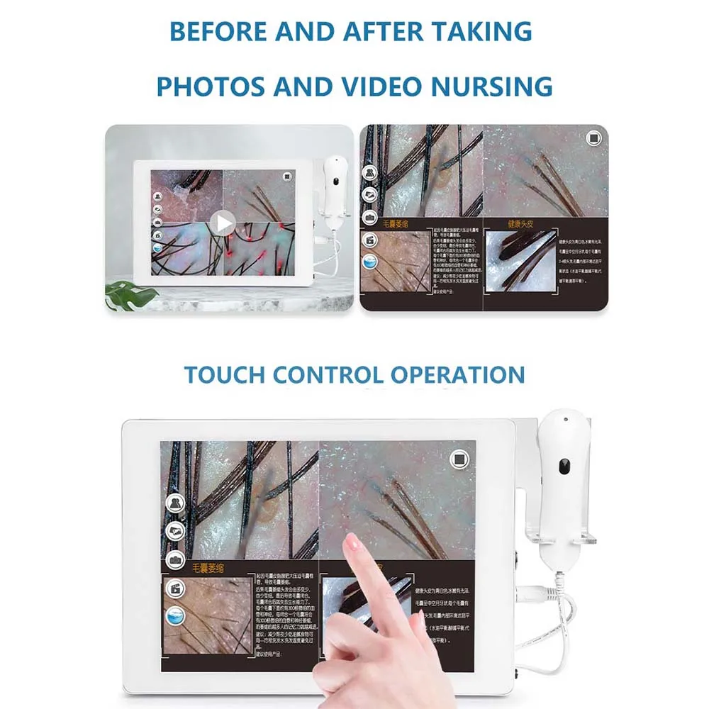 HD Digital Microscope Hair Follicle Detector Scalp Diagnostic Machine 15 Inch Rechargeable LCD Skin Analysis Scanner