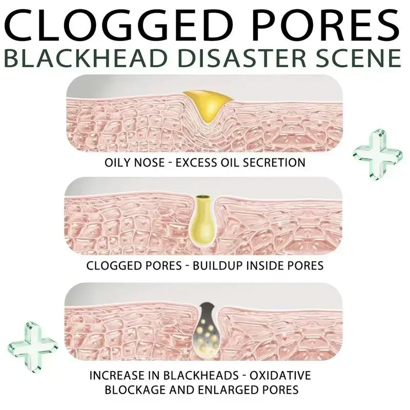 Krem do usuwania zaskórników z nosa, zwężający pory, naturalny roślinny preparat do oczyszczania porów, głęboka maska do czyszczenia nosa, pielęgnacja skóry twarzy.