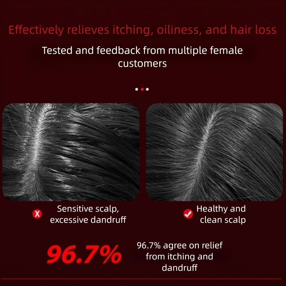 

Hair Electric Vibration Massage Comb Red Light Oil Applicator Scalp Massaging Brush Hair Growth Hair Care Red Light Hair Comb