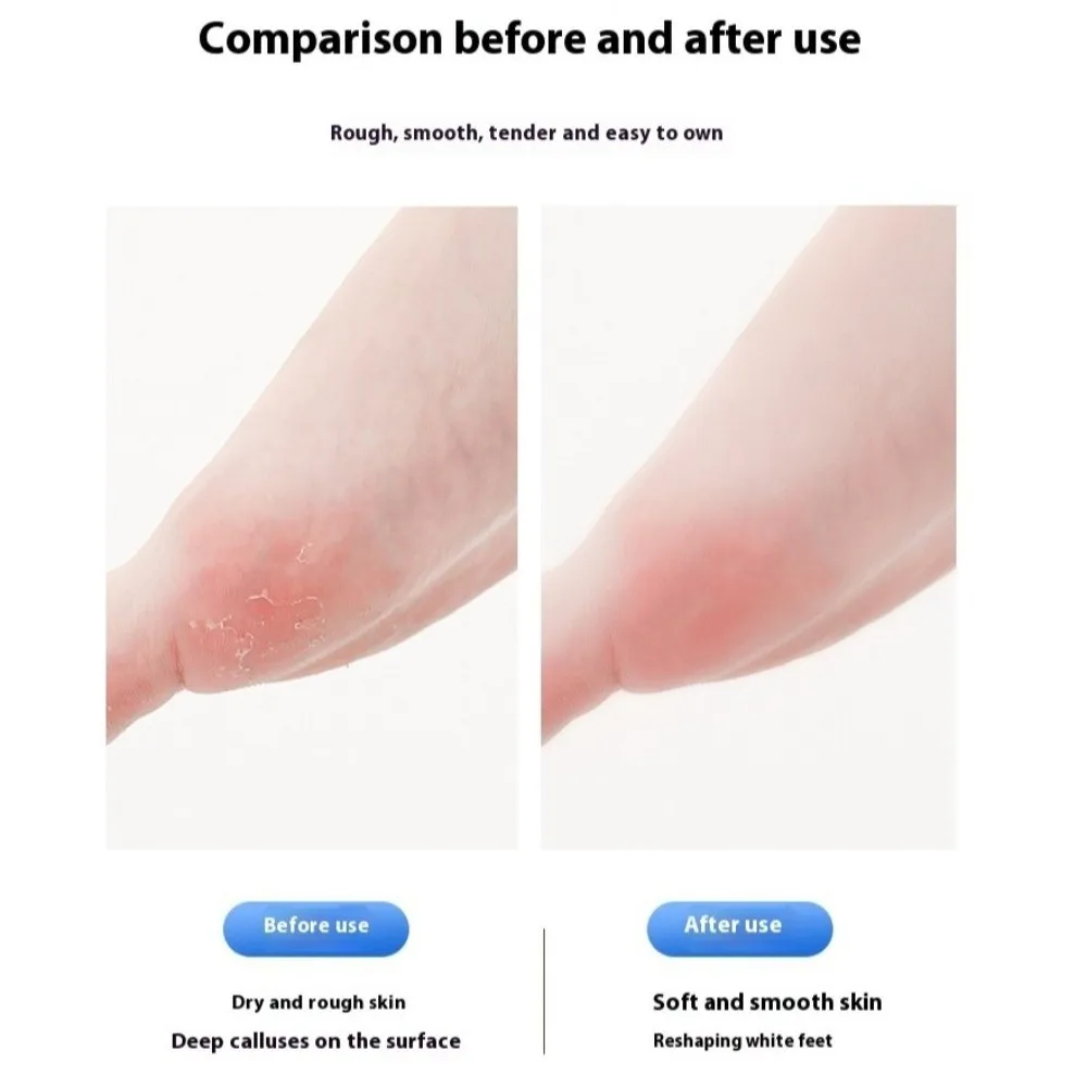 デジタルディスプレイ電動フットグラインダー足ケア充電式角質除去フットスクラバーフットファイル角質トリマー